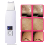 Ultrasonic Skin Scrubber