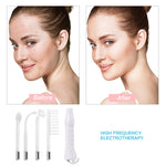 Facial Skin Tightening Machine