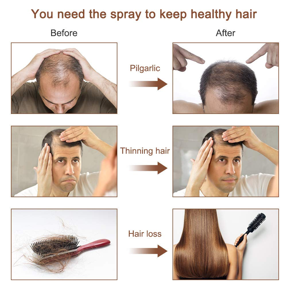 Hair Growth Spray